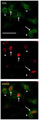 Age-Related Deterioration of Perineuronal Nets in the Primary Auditory Cortex of Mice